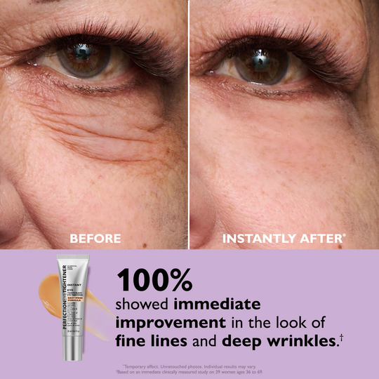 Instant Eye Tightening Cream